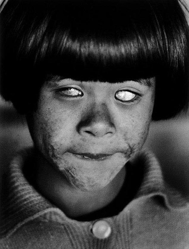 30. Hiroşima'da atom bombası tarafından kör edilen bir çocuk. 1945.