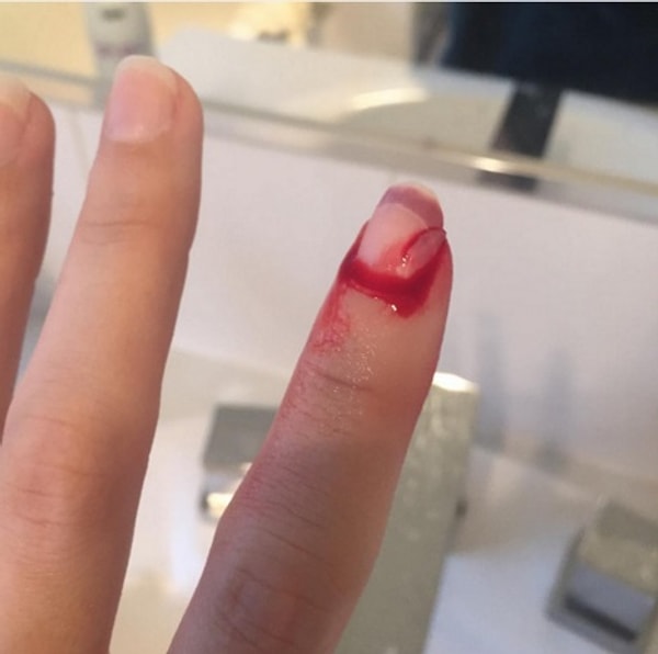 17. Маникюр -  кровавая бойня для пальцев.