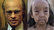 Sıra Dışı Hastalıkları Yüzünden Doğumlarından Beri Yaşlı Görünen 'Benjamin Button' Kardeşler