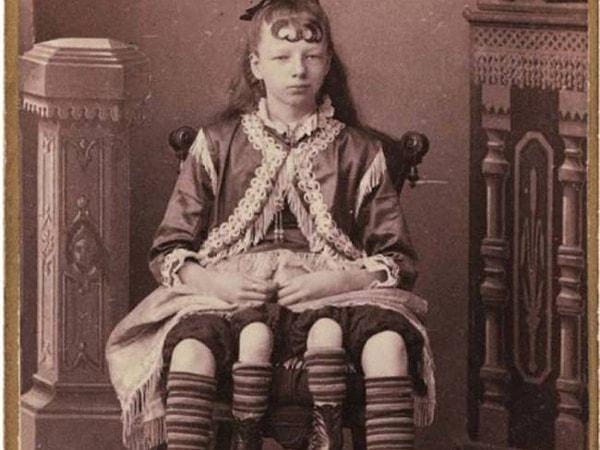 8. Josephine Corbin - Dört Bacaklı Kız
