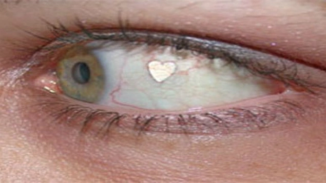 Göz Mücevheri- Hollanda