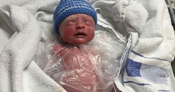 10 hafta erken doğan Isaac Derwent hayata başladığında sadece 1 kiloydu. Küçük bebeğin hayatını ise sandviç poşeti kurtardı!