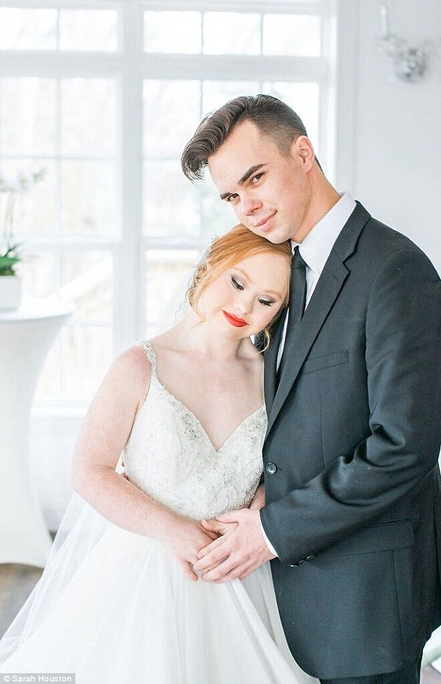 Bu Sefer Gelinlikle: Down Sendromlu Güzeller Güzeli Modelin Hayalleri Bir Bir Gerçek Oluyor