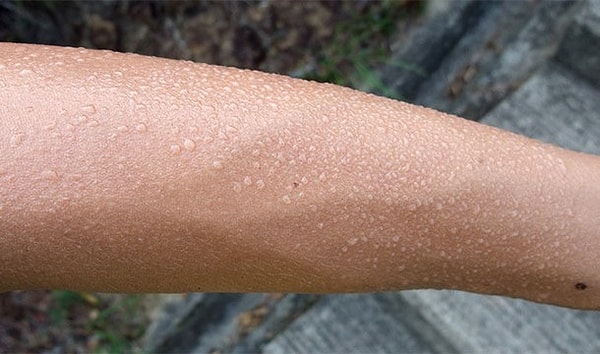 11. На самом деле человеческий пот абсолютно ничем не пахнет. Однако, им питаются бактерии, и мы чувствуем запах продуктов их жизнедеятельности