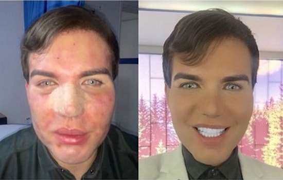 Он потратил 450 тысяч долларов, чтобы быть похожим на куклу Кена!