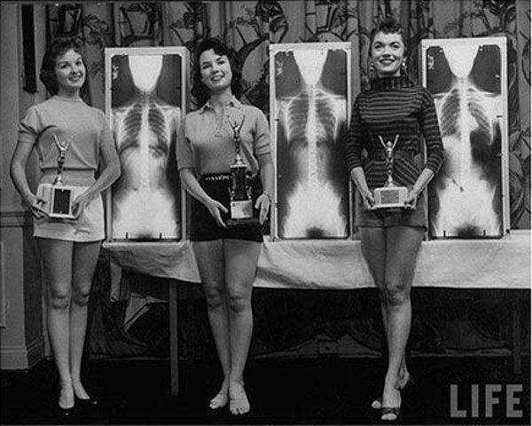 3. 'Bayan En İyi Duruş' ödüllerini sahipleri bir kiropraktörler (masörler) kongresinde poz veriyorlar. (1956)