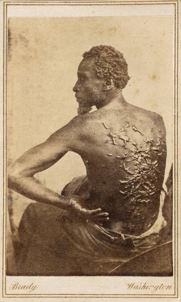 20. Esir düştüğü yerden kaçarak kurtulan Gordon isimli bir kölenin, kölelik karşıtı dağıtılan el ilanlarında kullanılmak üzere sırtındaki kırbaç izlerini göstererek verdiği poz, 1863.