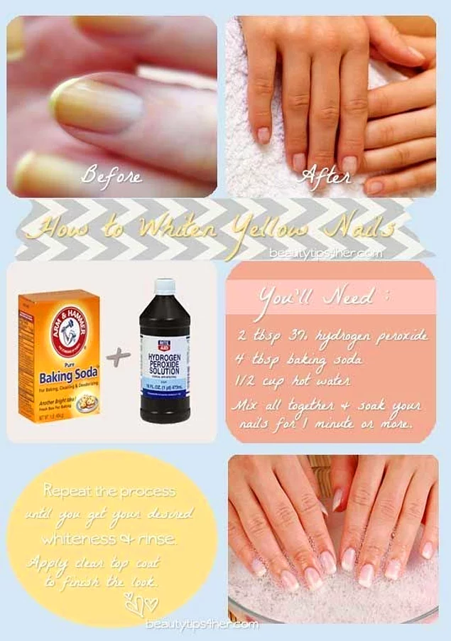 Don't have time for a full manicure session? Use baking soda and hydrogen peroxide to have whiter nails.