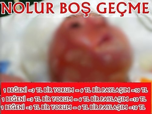 Saçma paylaşımlardan ilki: En çok karşımıza çıkanlardan.