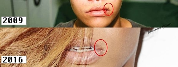 Следы на лице и боль в душе еще долго не давали девушке забыть об этом происшествии.