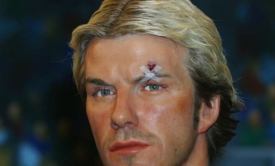 Sakatlığın Bile Hayırlısı! Tuhaf Şekillerde Sakatlanan 15 Futbolcu