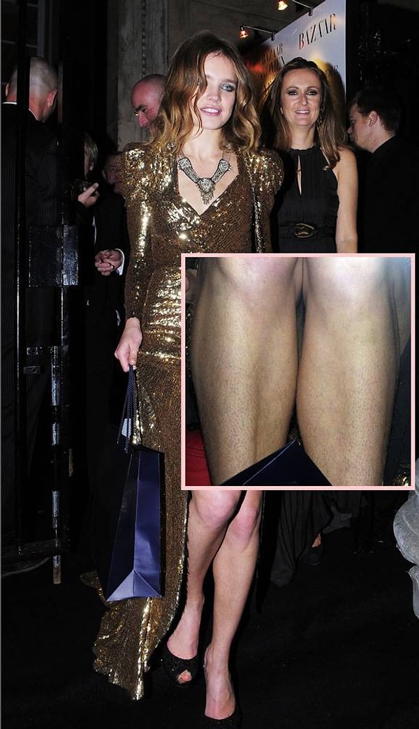 15. И даже милейшая Наталья Водянова.