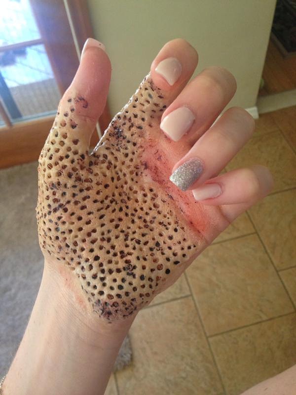 18. А некоторые люди просто обожают вызывать неприятные эмоции у трипофобов :)