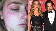 Meğer Olay Bambaşkaymış: Amber Heard Johnny Depp'ten Sürekli Dayak Yediğini İddia Etti!