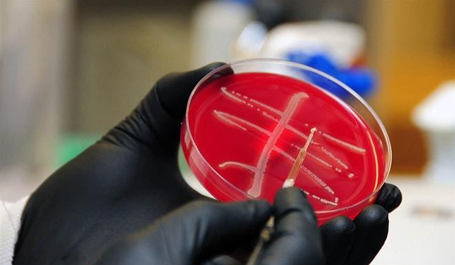 Korkulan Gerçekleşti: ABD'de Tüm Antibiyotiklere Dirençli Bir Bakteri Cinsi Bulundu