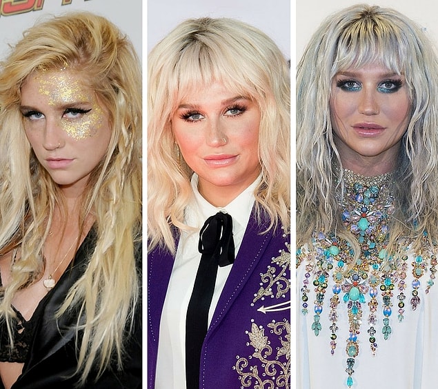 4. Kesha