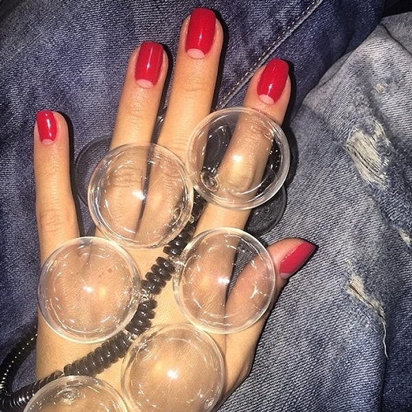 2. Кети Топурия