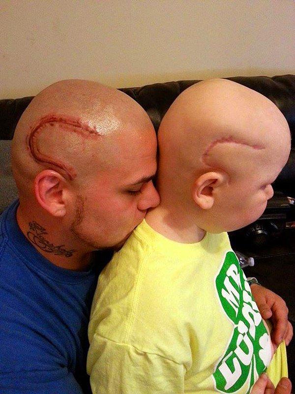Süper babanın çözümü ise, aynı yara izinden kendi kafasına dövme yaptırmak oldu.