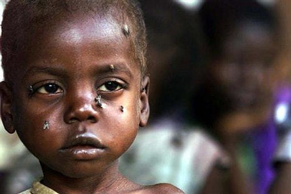11. Her gün dünya nüfusunun dokuzda biri, yani 800 milyon insan aç kalıyor.