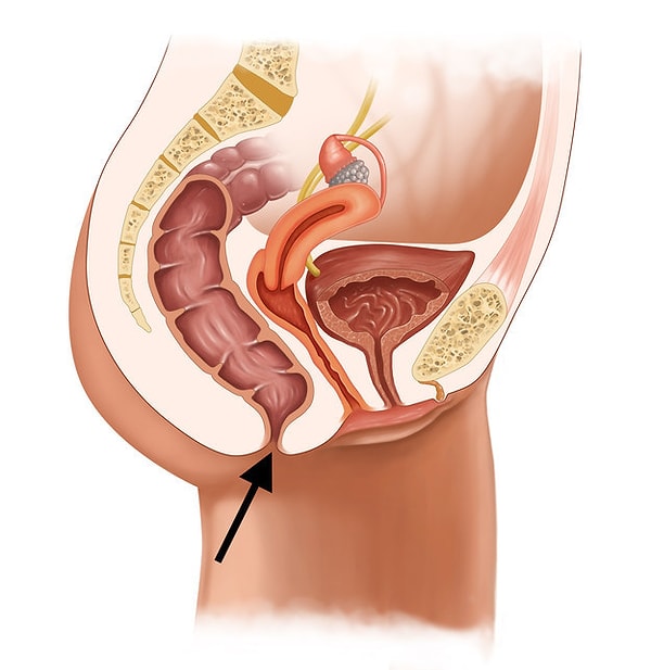 3. Как называется это отверстие?