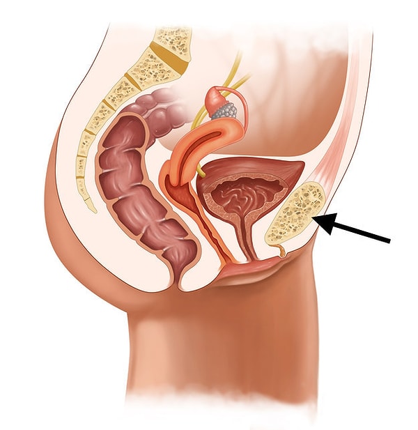6. Что эта за штука, имеющая структуру губки?