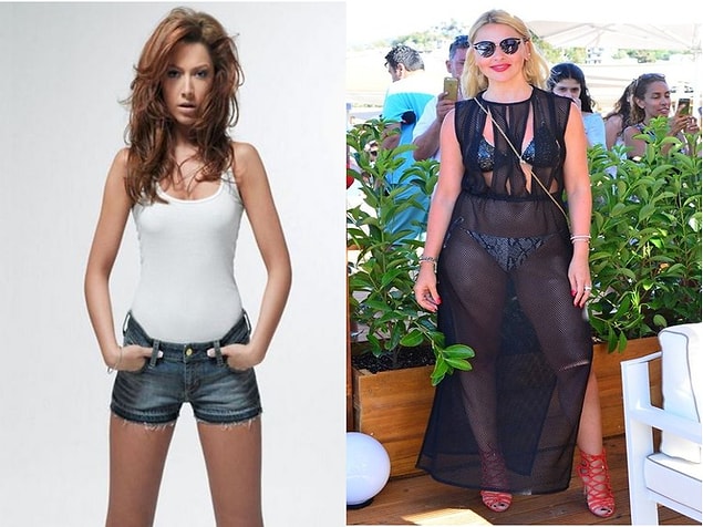 6. 3 aylık dönemlerle bir kilo alıp bir veriyor. Eski haline dönecektir. (Hadise)