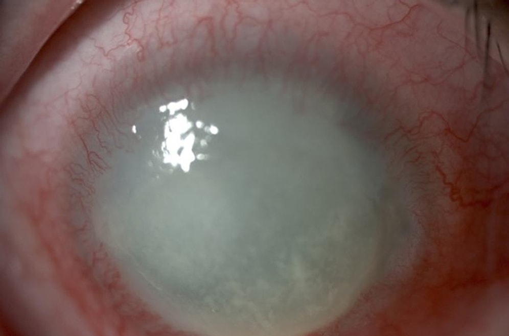 Dünyanın En Tehlikeli Ölüm Kampından Kaçabilecek misin?