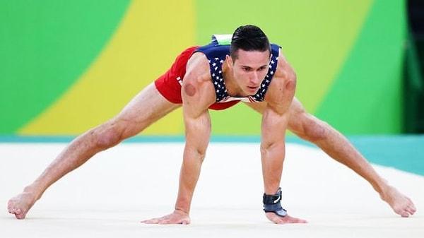Ve yine ABD takımından jimnastikçi Alex Naddour'un omzundaki bardak çekme izleri.
