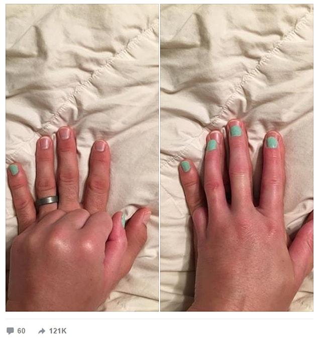 Matt found a way to make his wife feel good again. Libby can put nail polish on her 9 fingers and Matt offers his own finger as the 10th one.