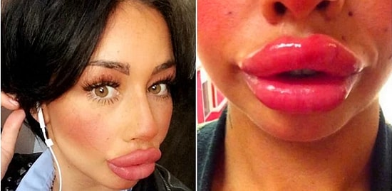 О девушке, которая немного переборщила с силиконом на губах