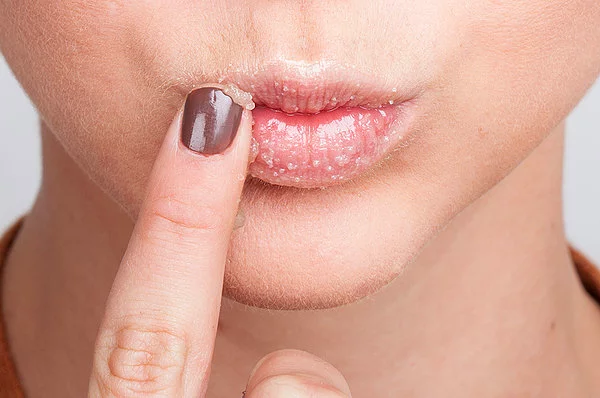 İskoç bir psikoloğa göre belirgin dudak tüberkülü olan kadınlar vajinal orgazmda daha başarılı oluyor.