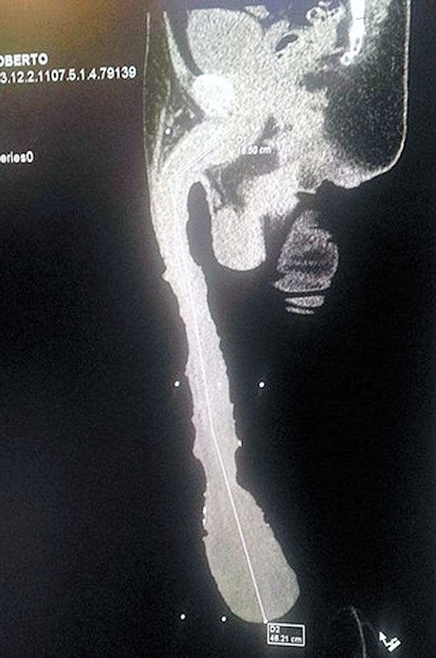 20. And finally, the longest human penis! This penis belongs to Mexican Roberto Esquivel Cabrera with 48 centimeters/18.1 inches.