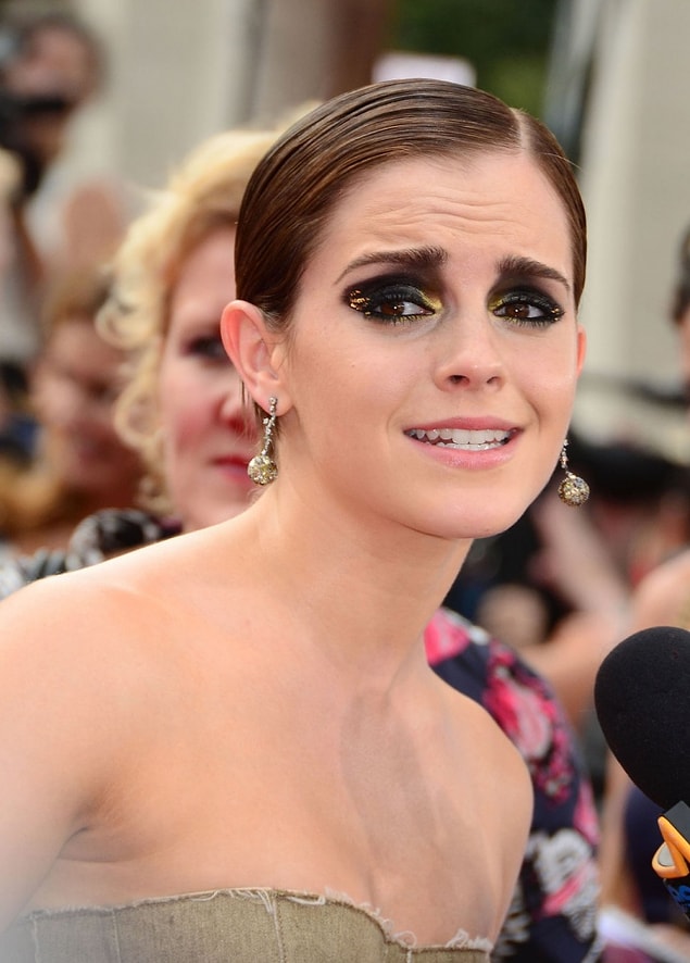 15. Our sweet Emma is also a victim of this panda eyes trend!