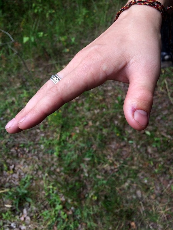 "Минут через 5 почувствовал, что начало неметь и немного болеть предплечье, затем плечо, затем второе плечо. На все минут 15. Потом второе плечо отпустило"