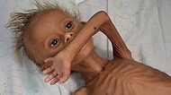 Yemen'deki Savaşın Çirkin Yüzü! Çatışmaların Ortasında Açlıktan Ölmek Üzere Bir Çocuk