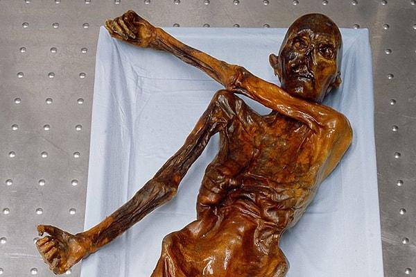 Ötzi'nin vücudunu bakterilere ve mantarlara karşı korumak üzere bir yöntem geliştiren profesör Friedrich Tiefenbrunner Ocak 2005'te açık kalp ameliyatı esnasında ölmüş.