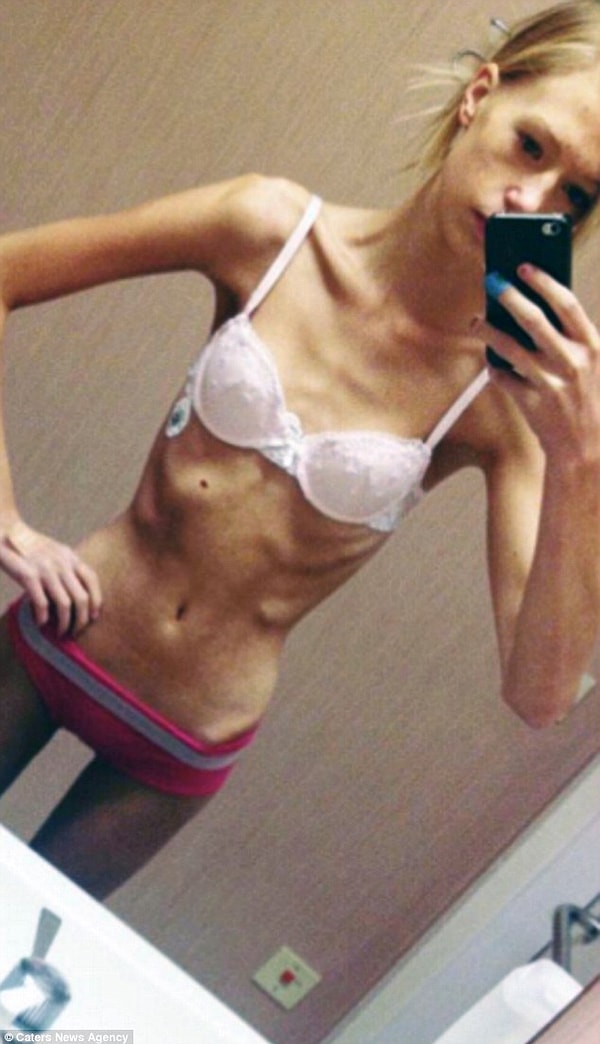 Все началось с того, что 19-летняя шведка Казандра решила похудеть, хотя толстой ее никак нельзя было назвать.