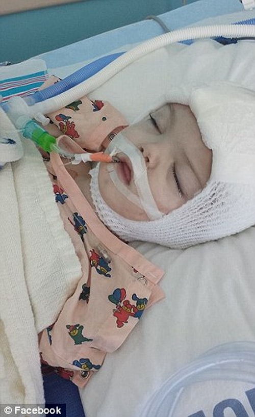13 aylık kardeşler Anias ve Jadon McDonald perşembe günü geçirdikleri kritik ameliyatın ardından New York'taki Montefiore Hastanesi'nde halen gözetim altında tutuluyorlar.