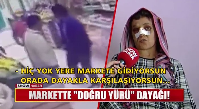 53 Yaşındaki Kadını "Doğru Yürü" Diyerek Öldüresiye Döven Maganda