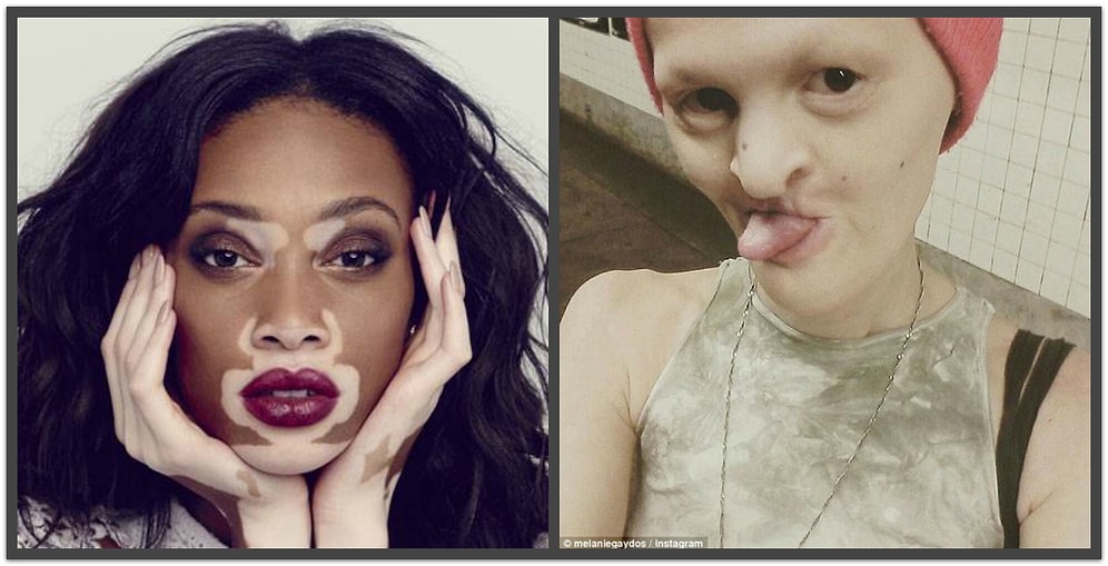 Топ-10 самых необычных моделей фэшн-индустрии