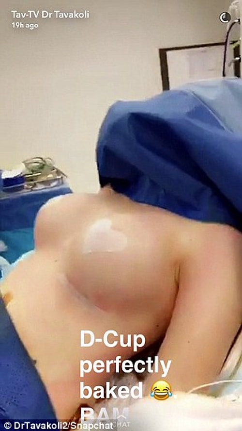 Sosyal medya trendini 7 ay önce başlatmış. O zamandan beri de uygulama 18-28 yaş arası kadınlarda yaygınlaştı.