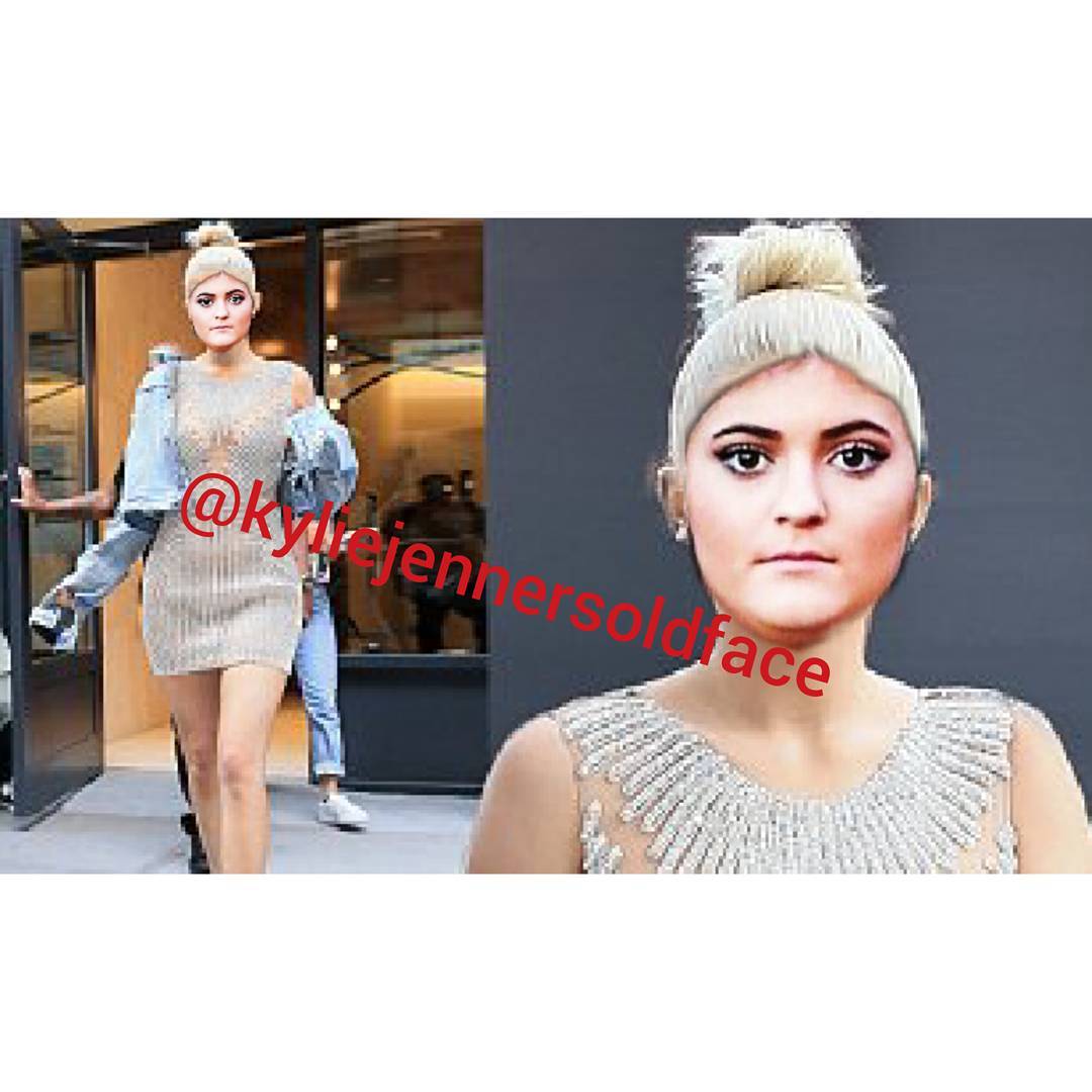 Estetik Harikası Kylie Jenner�a Eski Suratını Hatırlatan Hesaptan 17
