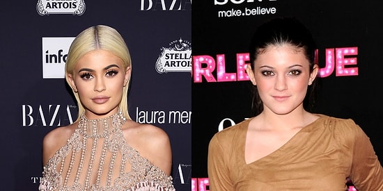 Кайли Дженнер решили напомнить, как она выглядела до пластических операций