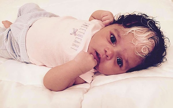 4. «Мы не знаем, откуда появилась эта генетическая особенность – мою бабушку удочерили, когда она была маленькой, и она ничего не помнит о своих биологических родителях», - рассказала Бриана