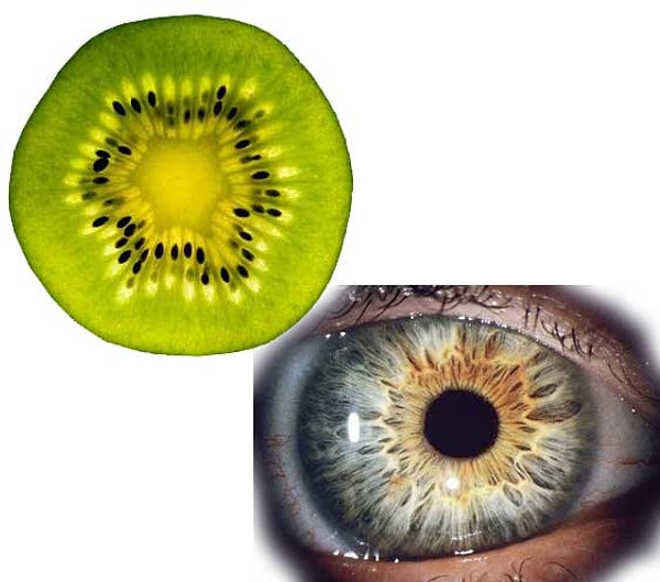 8. киви = радужка глаза