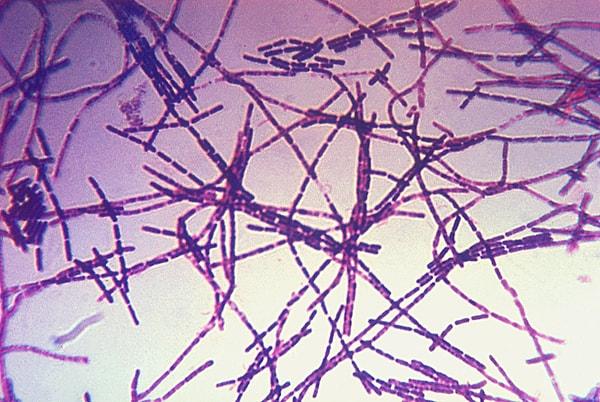 Geçtiğimiz günlerde Northern Arizona Üniversitesi'nden bir ekip, bölgede bulunan bakteri sporlarını inceleyerek salgının iç yüzünü ortaya çıkarmaya koyuldu.