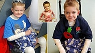 Acımasız Bir Cilt Hastalığıyla Gülümsemekten Vazgeçmeden Savaşan 11 Yaşındaki Rhys Williams