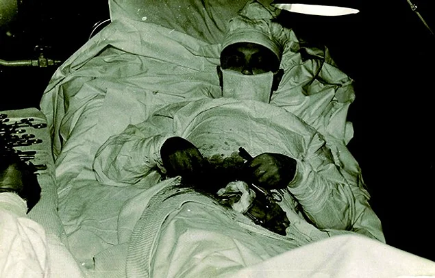 Kendi apandisit ameliyatını kendi yapan Sovyet doktor (1961)