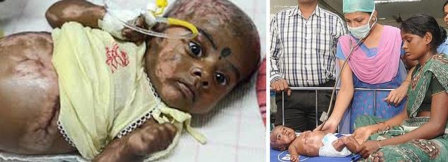 6. Indian baby to be combusted four times!