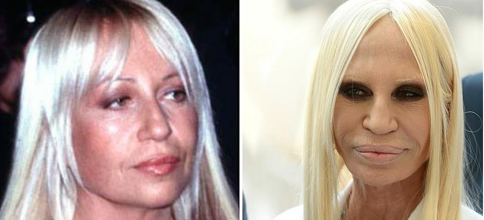 10 звезд, которым не удалось постареть красиво